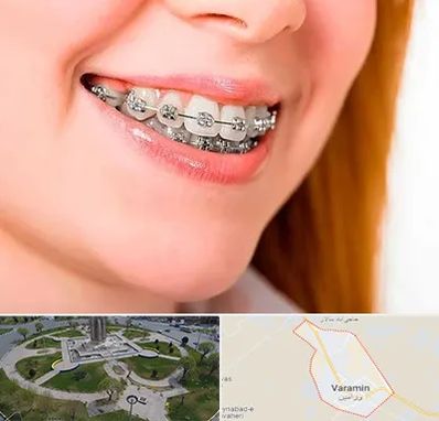 ارتودنسی ارزان در ورامین