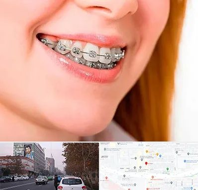 ارتودنسی ارزان در کارگر شمالی 