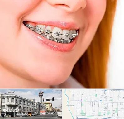 ارتودنسی ارزان در 17شهریور