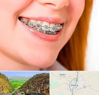 ارتودنسی ارزان در کامیاران