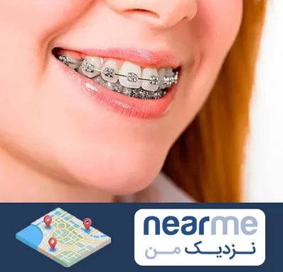 ارتودنسی ارزان در نزدیک من