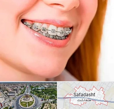 ارتودنسی ارزان در صفادشت