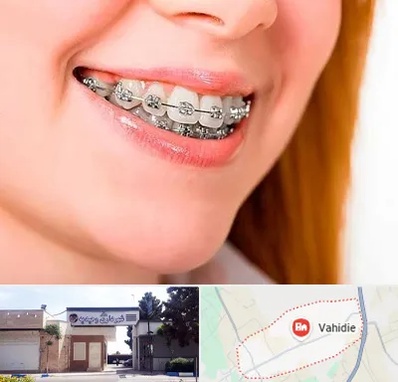 ارتودنسی ارزان در وحیدیه شهریار