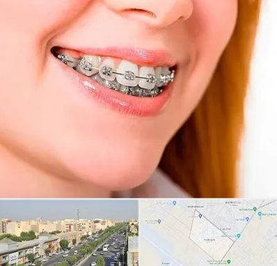 ارتودنسی ارزان در کیانمهر کرج 