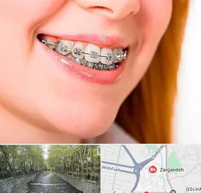 ارتودنسی ارزان در زرگنده