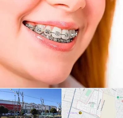 ارتودنسی ارزان در فاز دو اندیشه