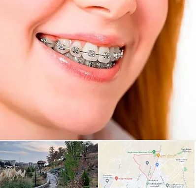 ارتودنسی ارزان در باغستان کرج 