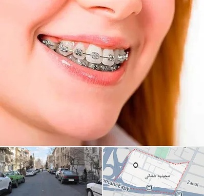 ارتودنسی ارزان در مجیدیه شمالی