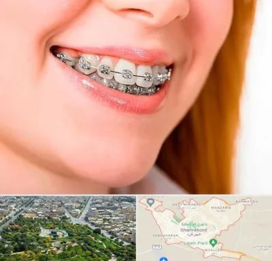 ارتودنسی ارزان در شهرکرد