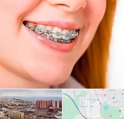 ارتودنسی ارزان در سهند تبریز