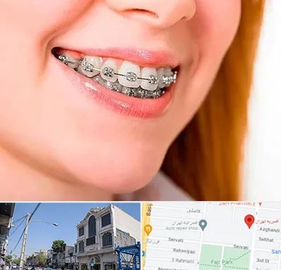 ارتودنسی ارزان در افسریه 