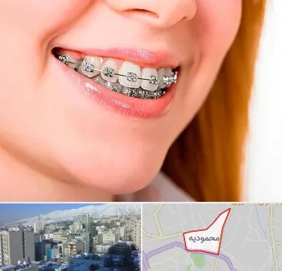 ارتودنسی ارزان در محمودیه