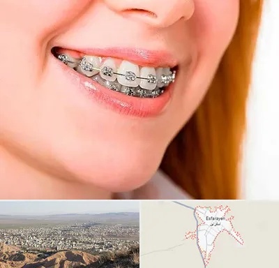 ارتودنسی ارزان در اسفراین