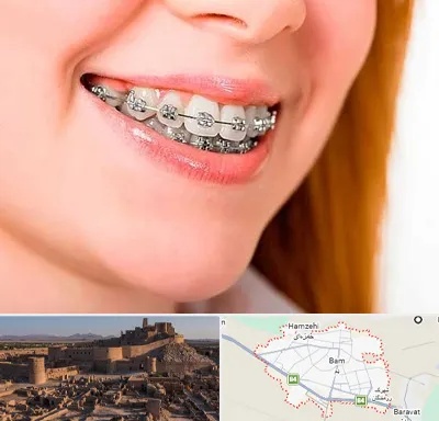 ارتودنسی ارزان در بم