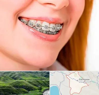 ارتودنسی ارزان در گچساران