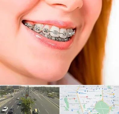 ارتودنسی ارزان در منطقه 17 تهران 