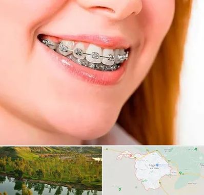 ارتودنسی ارزان در بهبهان