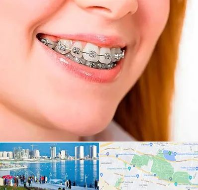 ارتودنسی ارزان در چیتگر 