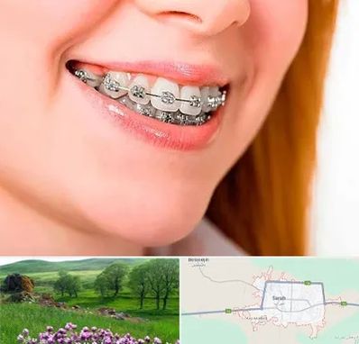 ارتودنسی ارزان در سراب