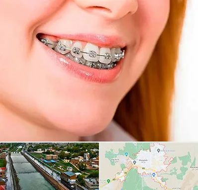 ارتودنسی ارزان در مراغه