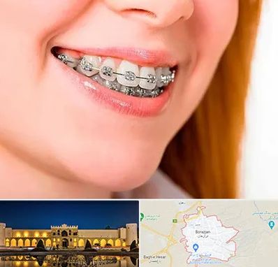 ارتودنسی ارزان در برازجان