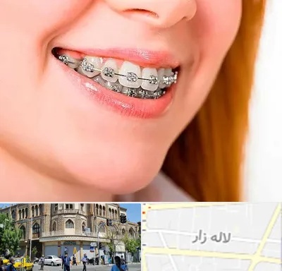 ارتودنسی ارزان در لاله زار