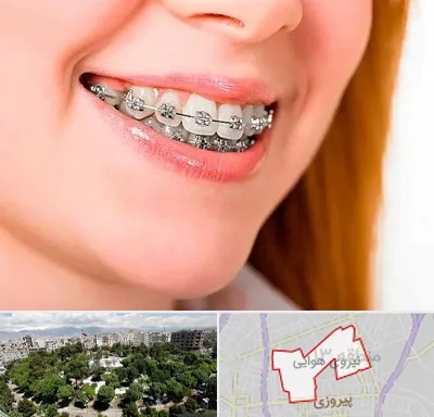 ارتودنسی ارزان در نیروی هوایی