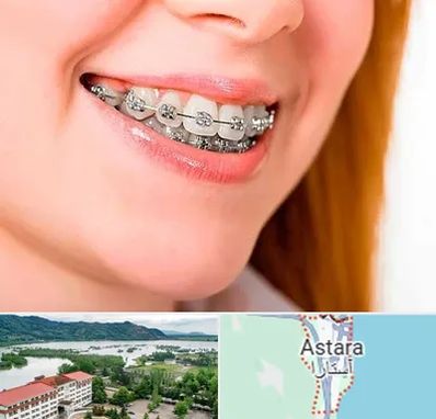 ارتودنسی ارزان در آستارا
