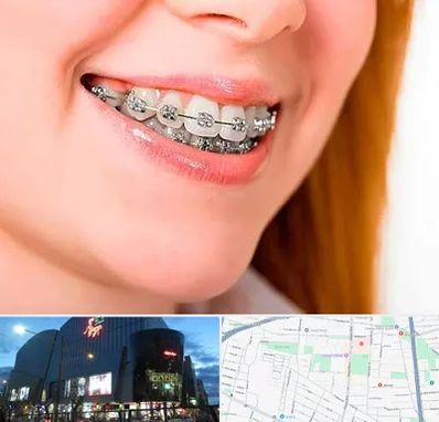 ارتودنسی ارزان در بلوار اباذر