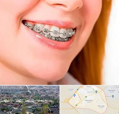 ارتودنسی ارزان در رباط کریم