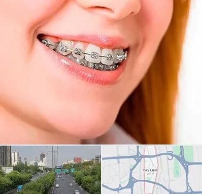 ارتودنسی ارزان در توانیر