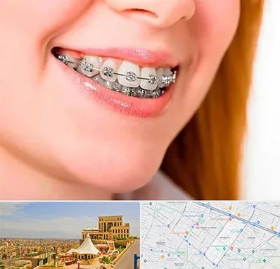 ارتودنسی ارزان در هاشمیه مشهد 