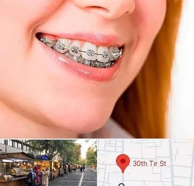 ارتودنسی ارزان در سی تیر