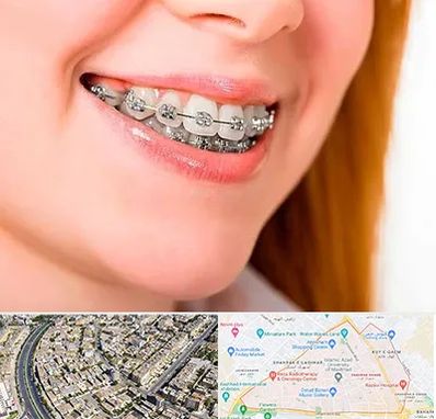 ارتودنسی ارزان در شهرک غرب مشهد 