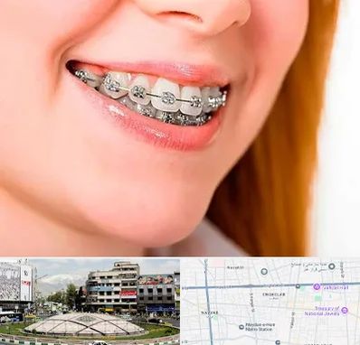 ارتودنسی ارزان در مرکز تهران