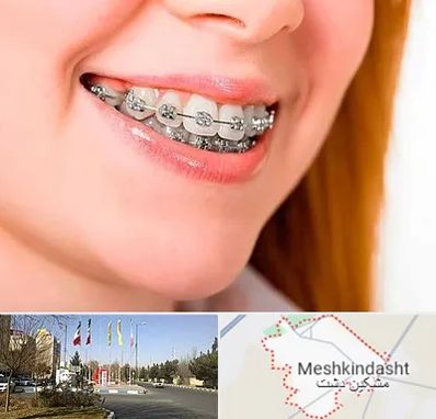 ارتودنسی ارزان در مشکین دشت