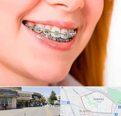 ارتودنسی ارزان در پرواز تبریز