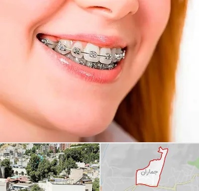 ارتودنسی ارزان در جماران