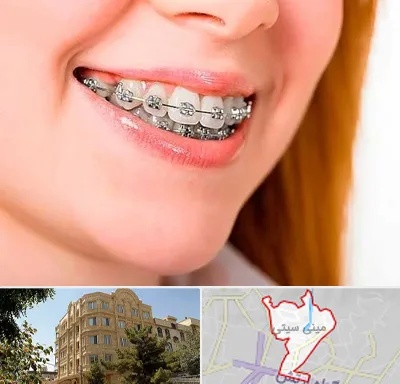 ارتودنسی ارزان در مینی سیتی