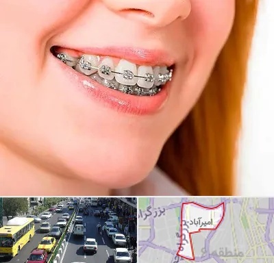 ارتودنسی ارزان در امیرآباد