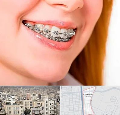 ارتودنسی ارزان در اسکندری