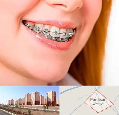 ارتودنسی ارزان در پردیسان قم