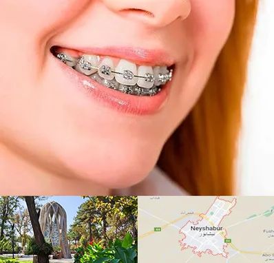 ارتودنسی ارزان در نیشابور