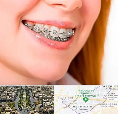 ارتودنسی ارزان در نارمک 
