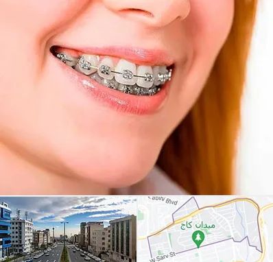 ارتودنسی ارزان در سعادت آباد 