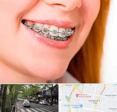 ارتودنسی ارزان در ظفر 