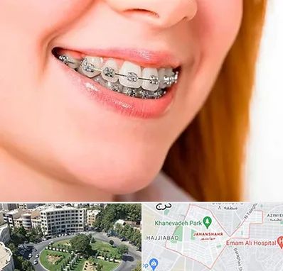 ارتودنسی ارزان در جهانشهر کرج 