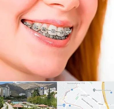 ارتودنسی ارزان در شهر زیبا 