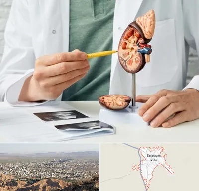 دکتر اورولوژیست در اسفراین