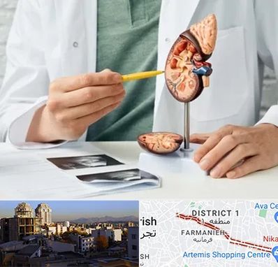 دکتر اورولوژیست در فرمانیه 